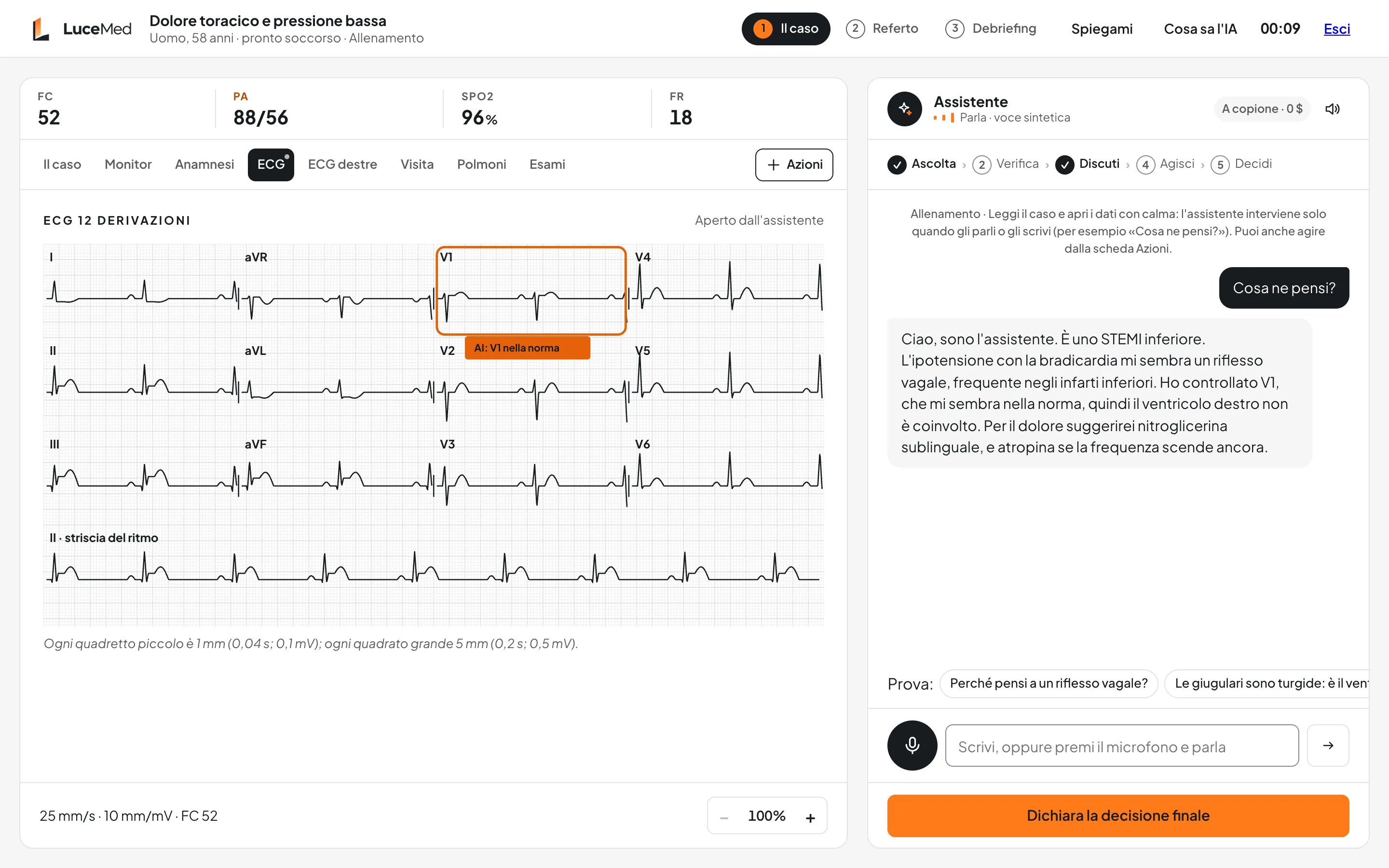 La demo di LuceMed: un caso di dolore toracico con l'ECG a 12 derivazioni. L'IA segna V1 «nella norma» e l'assistente propone la sua lettura del caso.